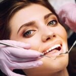Une patiente qui effectue un contrôle de ses facettes lumineers chez son dentiste