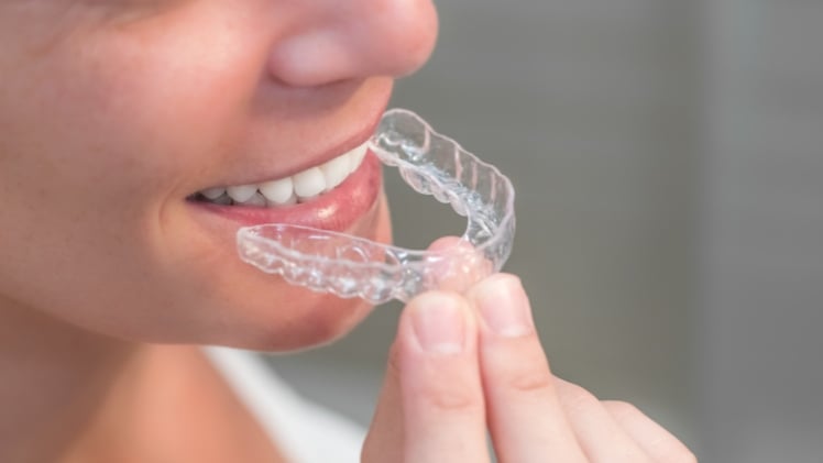 Un appareil dentaire transparent pour adulte