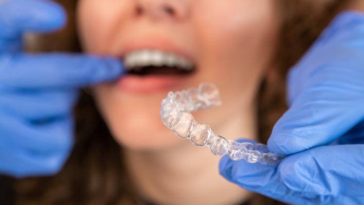 Un dentiste qui montre à une patiente à quoi servent les taquets invisalign