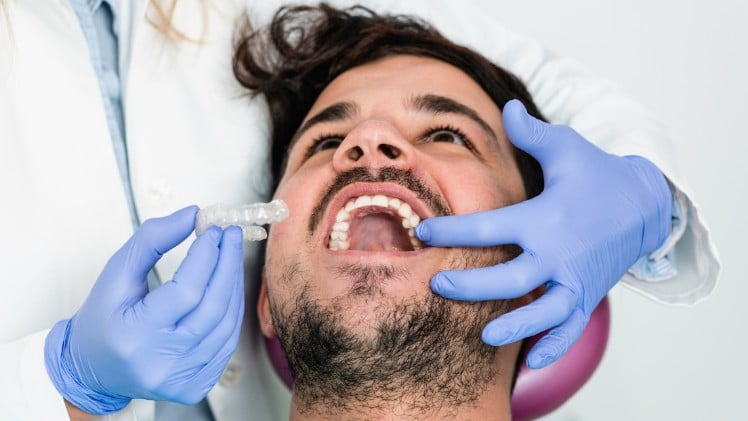 Un homme qui se fait mettre un aligneur dentaire transparent