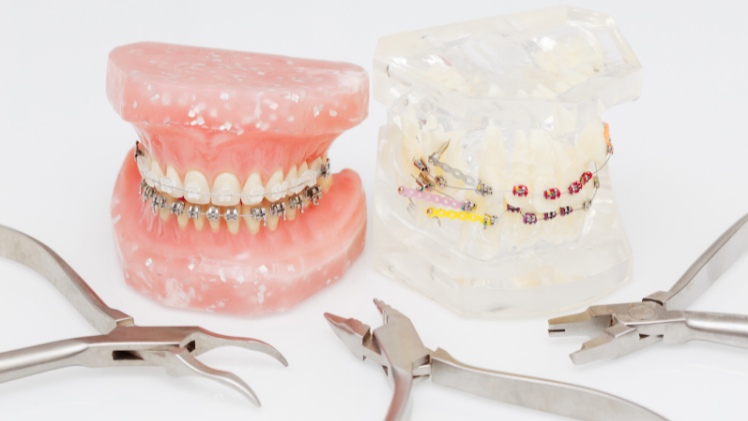 Les matériels utilisés en dentisterie et en orthodontie