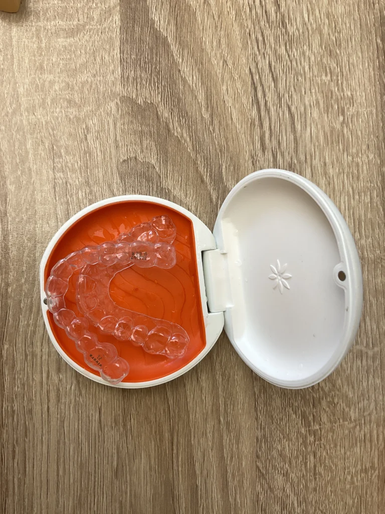 Gouttière pour redresser les dents - Déroulement du traitement - La Clinique du Sourire Die