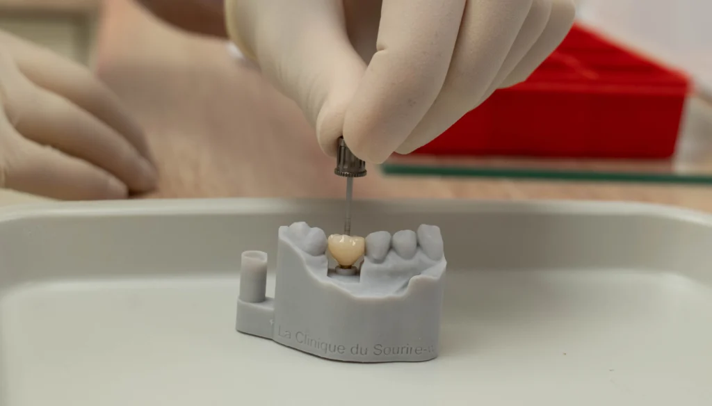Implant dentaire préparé sur modèle à la Clinique du Sourire à Die